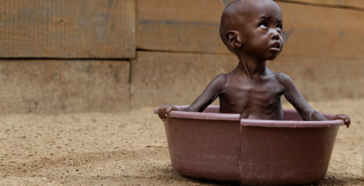 Malnutrizione, oltre 200 milioni di bambini colpiti- MasterX