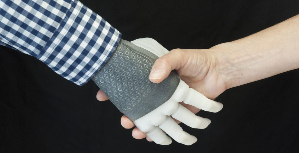Primo trapianto di protesi permanente: la mano robotica è made in Italy - MasterX