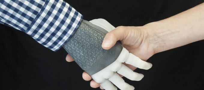 Primo trapianto di protesi permanente: la mano robotica è made in Italy - MasterX