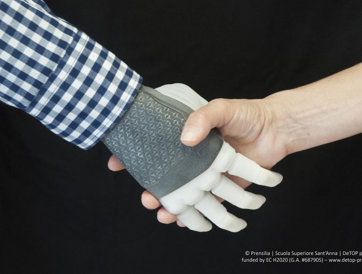 Primo trapianto di protesi permanente: la mano robotica è made in Italy - MasterX